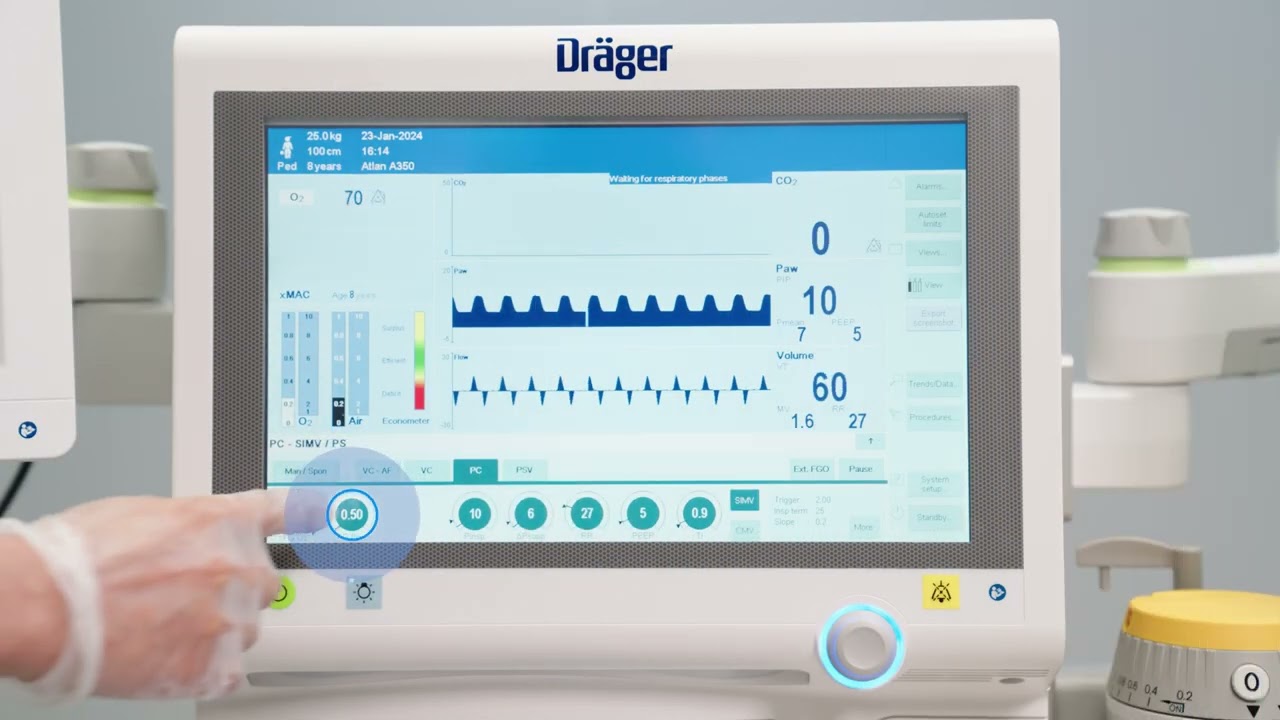 Low-flow anaesthesia for lung protective ventilation with Atlan anaesthesia workstations