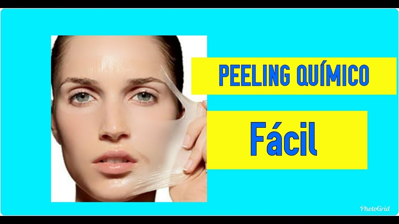 CURSO DE PEELING ONLINE - APRENDA PEELING PASSO A PASSO