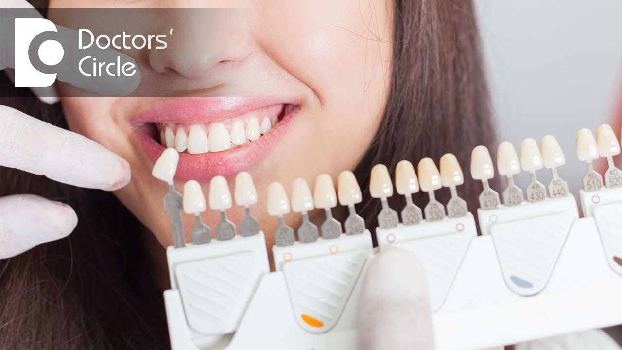 What are Dental Crowns & Tooth Bridges? - Dr. Rajeev Kumar G