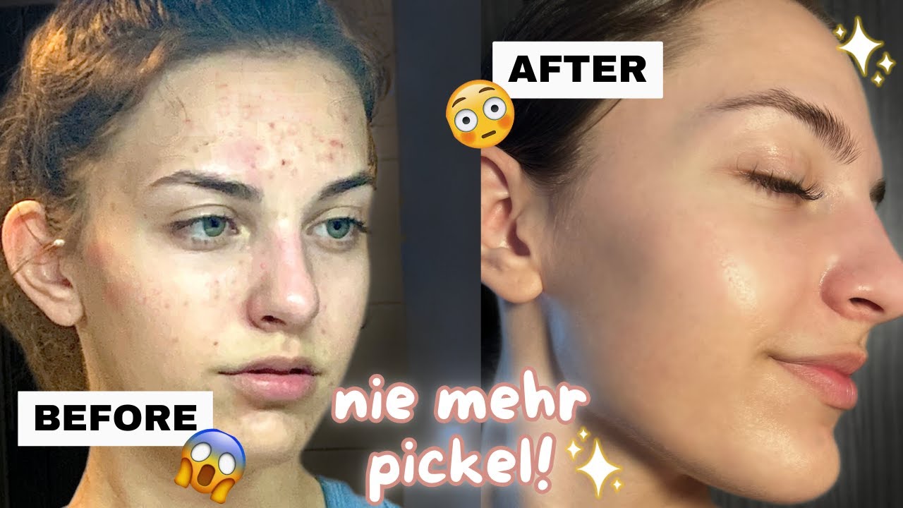 SO bekommst du reine Haut ✨- skincare routine, summer glow up tipps