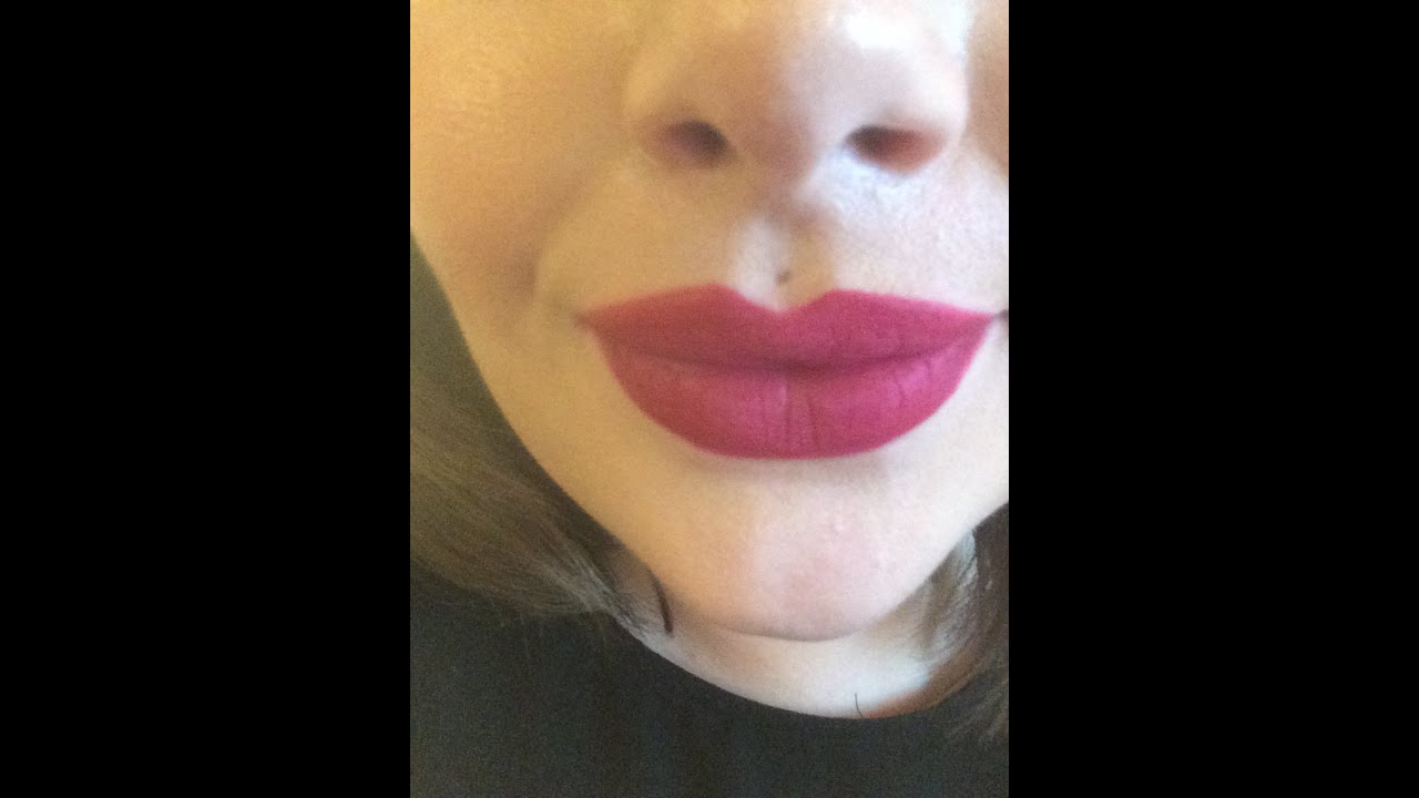 Medusa piercing scar revision surgery
