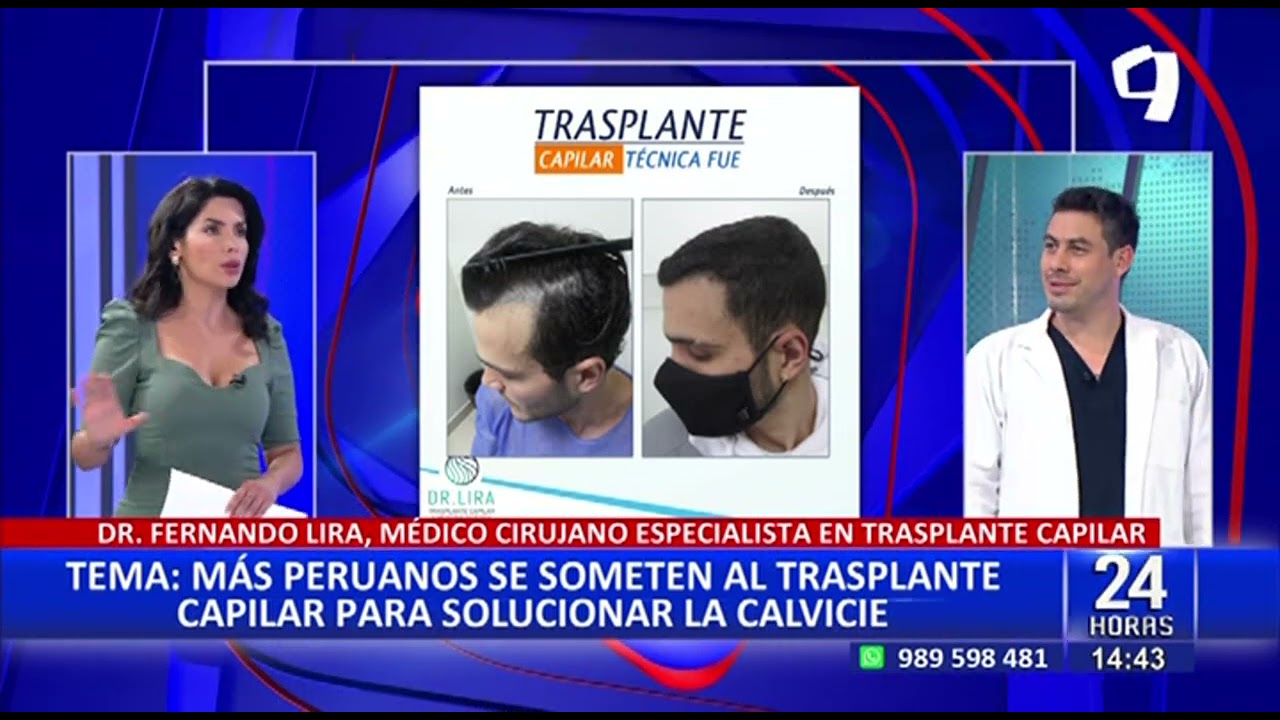 Trasplante capilar: Cirujano especialista da detalles acerca de este novedoso tratamiento