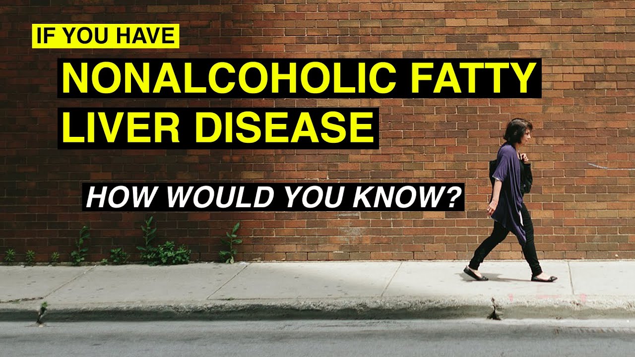 If You Have NAFLD, How Would You Know?