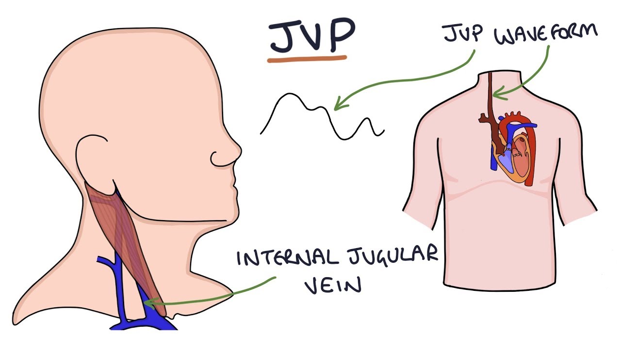 Understanding Jugular Venous Pressure (JVP)