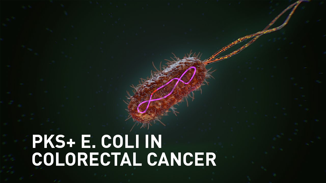 A mutational signature in human colorectal cancer induced by genitoxic pks+ E. coli
