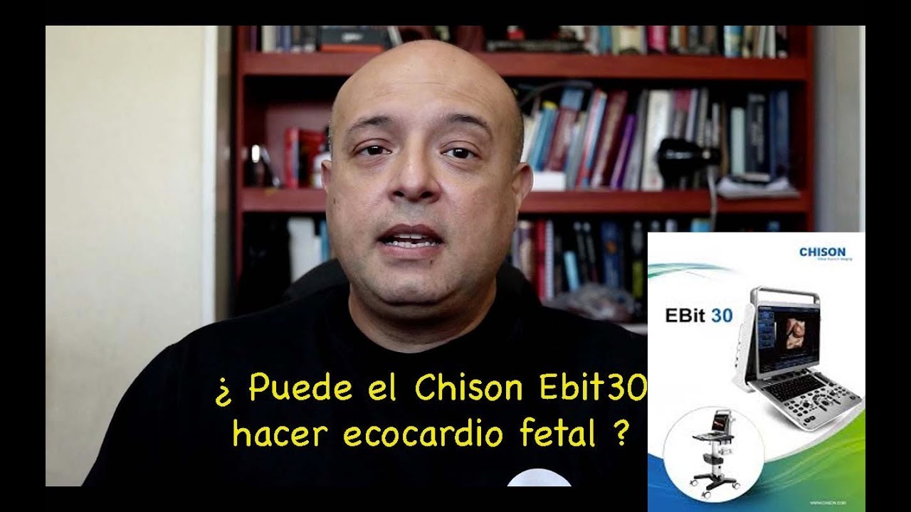 ¿Puede el Chison Ebit30 hacer ecocardio fetal?