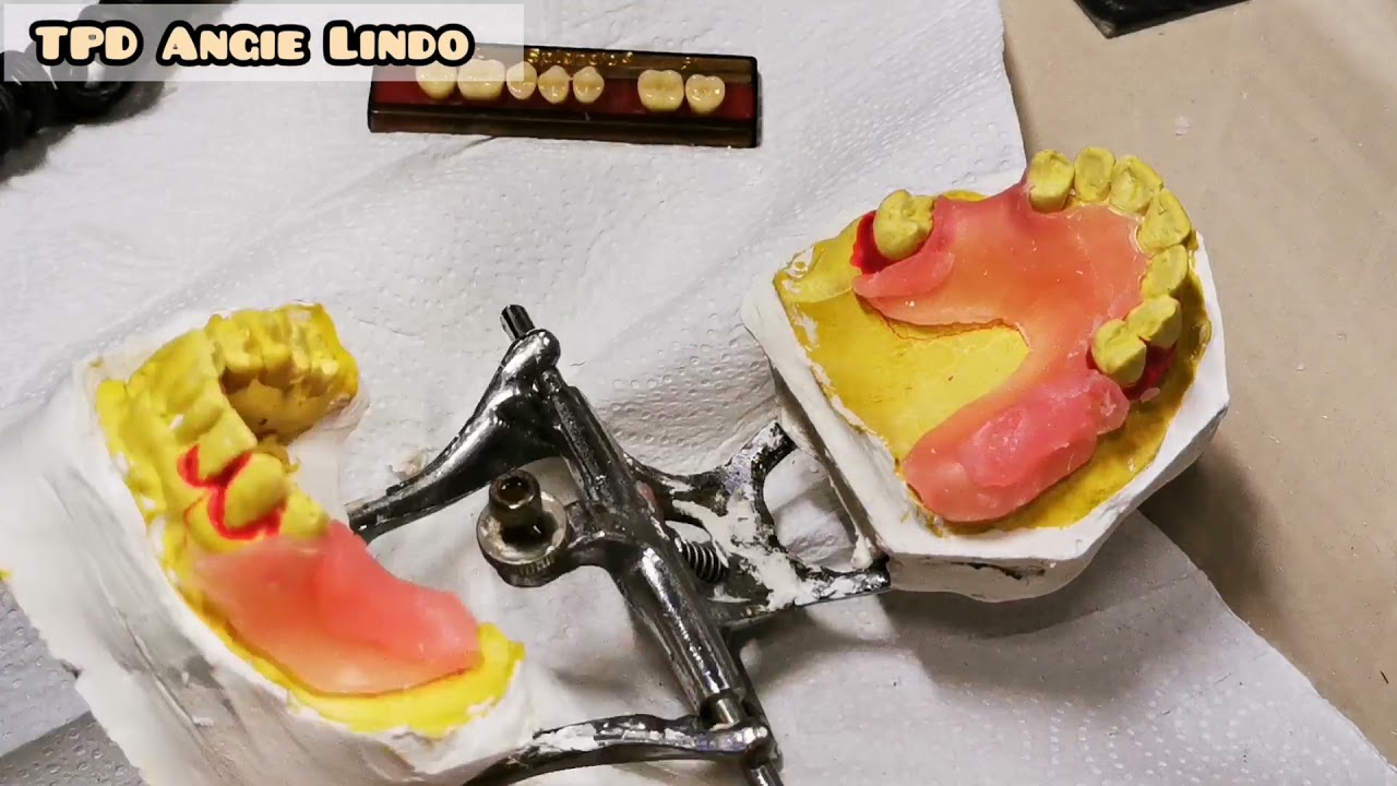 Articular y encerar caso prótesis dental Acrílico por inyección semiflexible (API)