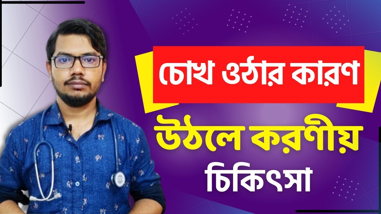 চোখ ওঠার কারণ / চোখ উঠলে করণীয় / chokh utha treatment / চোখ লাল হওয়ার কারণ ও প্রতিকার