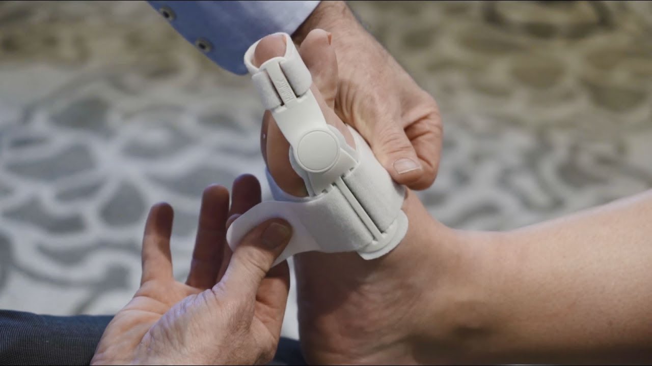 The Benefits of Using an Aircast Hallufix Bunion Aid Splint - Waikato Podiatry Clinic