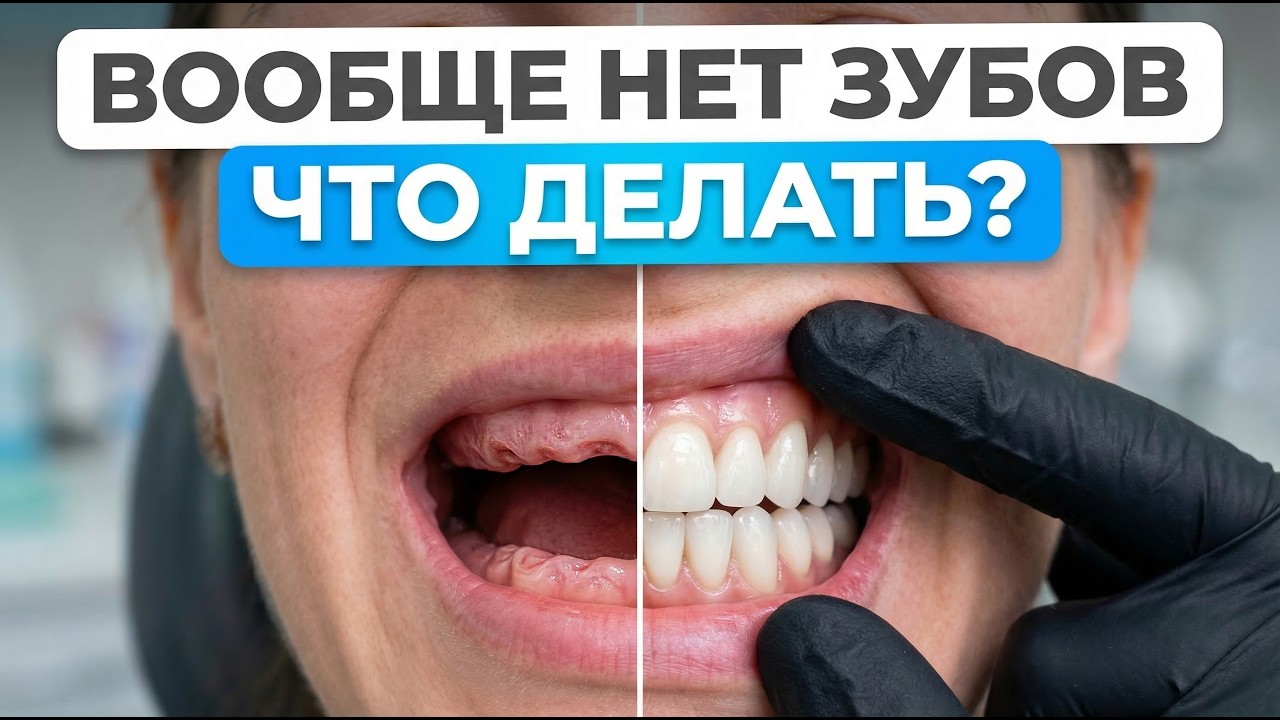ДЕЛАЙТЕ ЭТО, если у вас НЕТ ЗУБОВ!Можно ли ставить импланты на все зубы?/Стоматология Маэстро Улыбок
