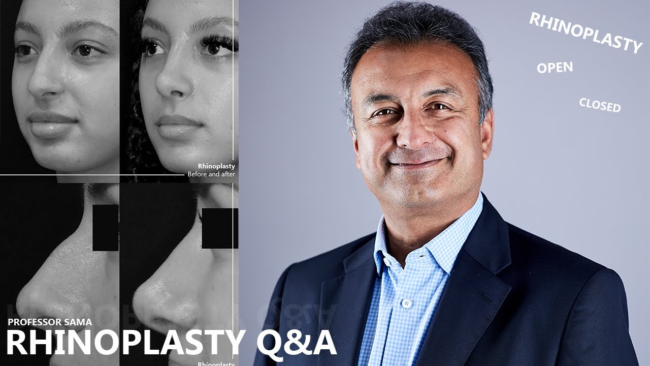 Rhinoplasty Q&A with Professor Sama