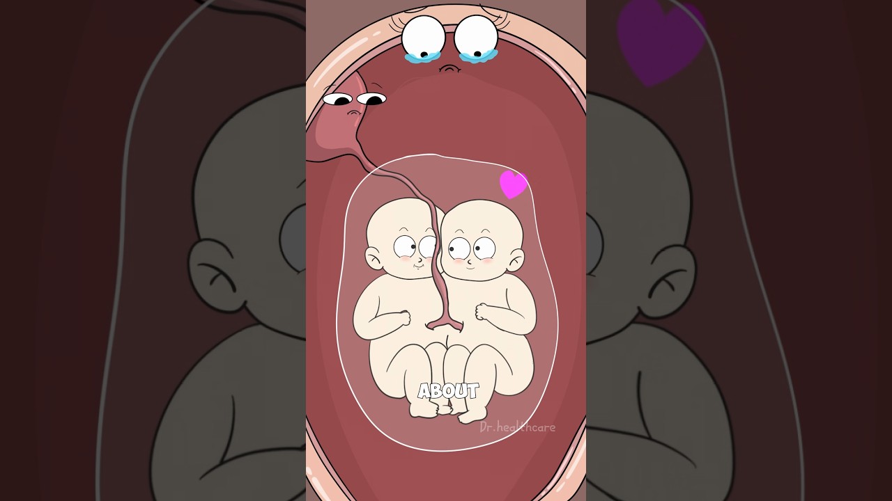 How Do Conjoined Twins Form?    #animation#hot#funny #shorts