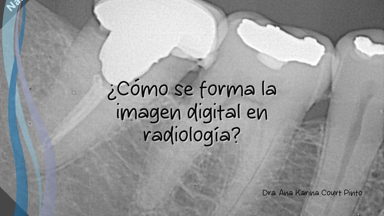 ¿Cómo se forma la imagen digital en radiología?