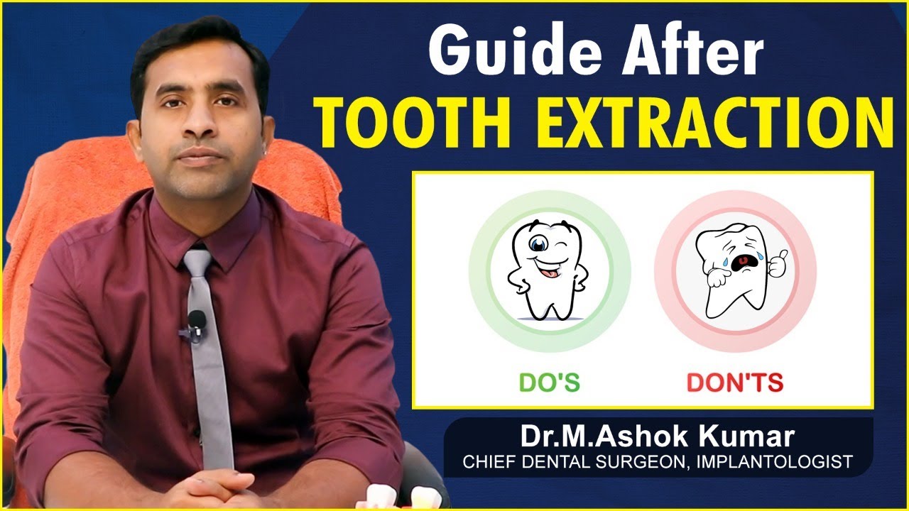 Do&rsquo;s and Don&rsquo;ts after a Tooth Extraction || Guide After Tooth Extraction || Eledent Dental Hospitals