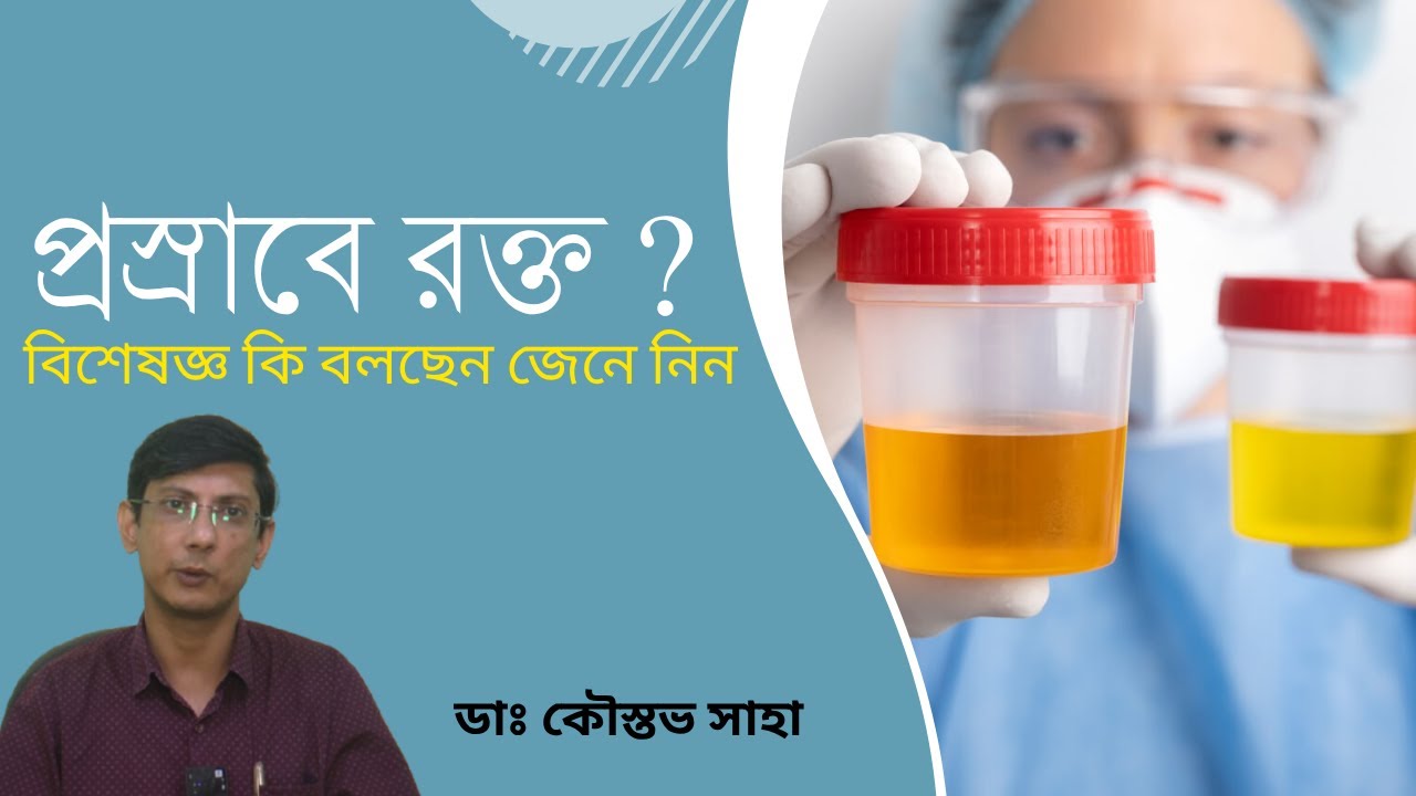 আপনার প্রস্রাবে রক্ত ? কেন ? কি করবেন ? জেনে নিন বিশিষ্ট ইউরোলজিস্ট কি বলেছেন ।।