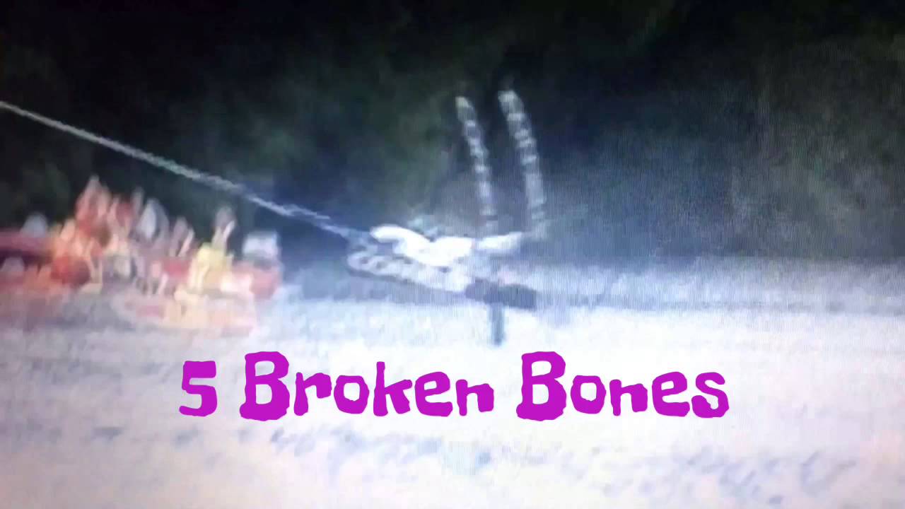 Vicky Campbell Budd waterski jump crash amazing crash out the front cable crash