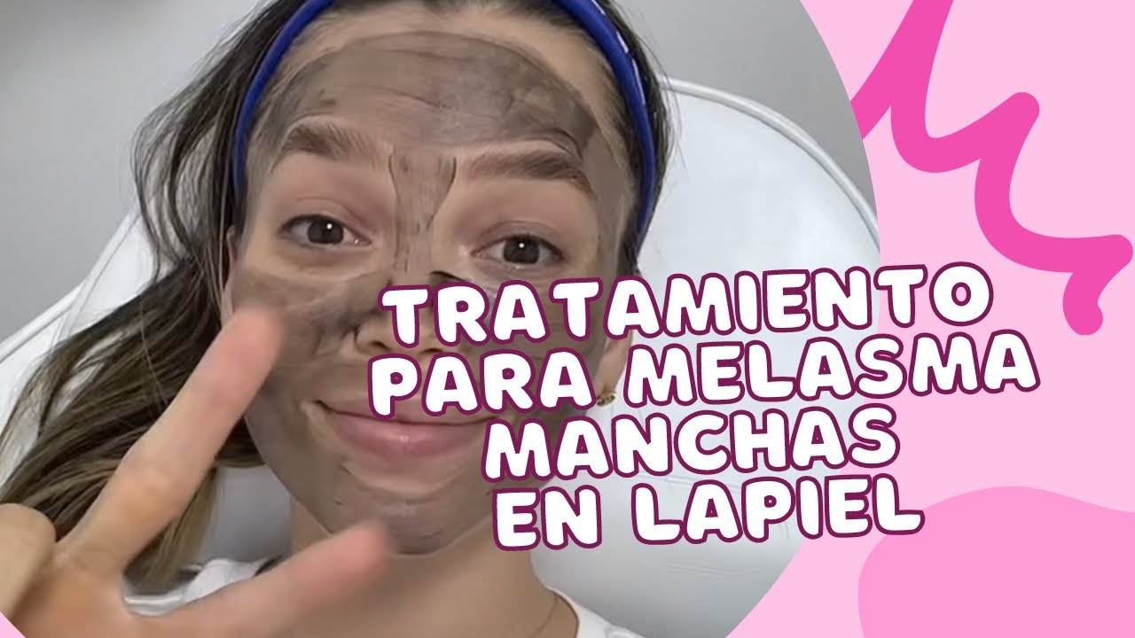 Tratamientos para Melasma | Pa&ntilde;o o Manchas en la Piel | Lylo Fa