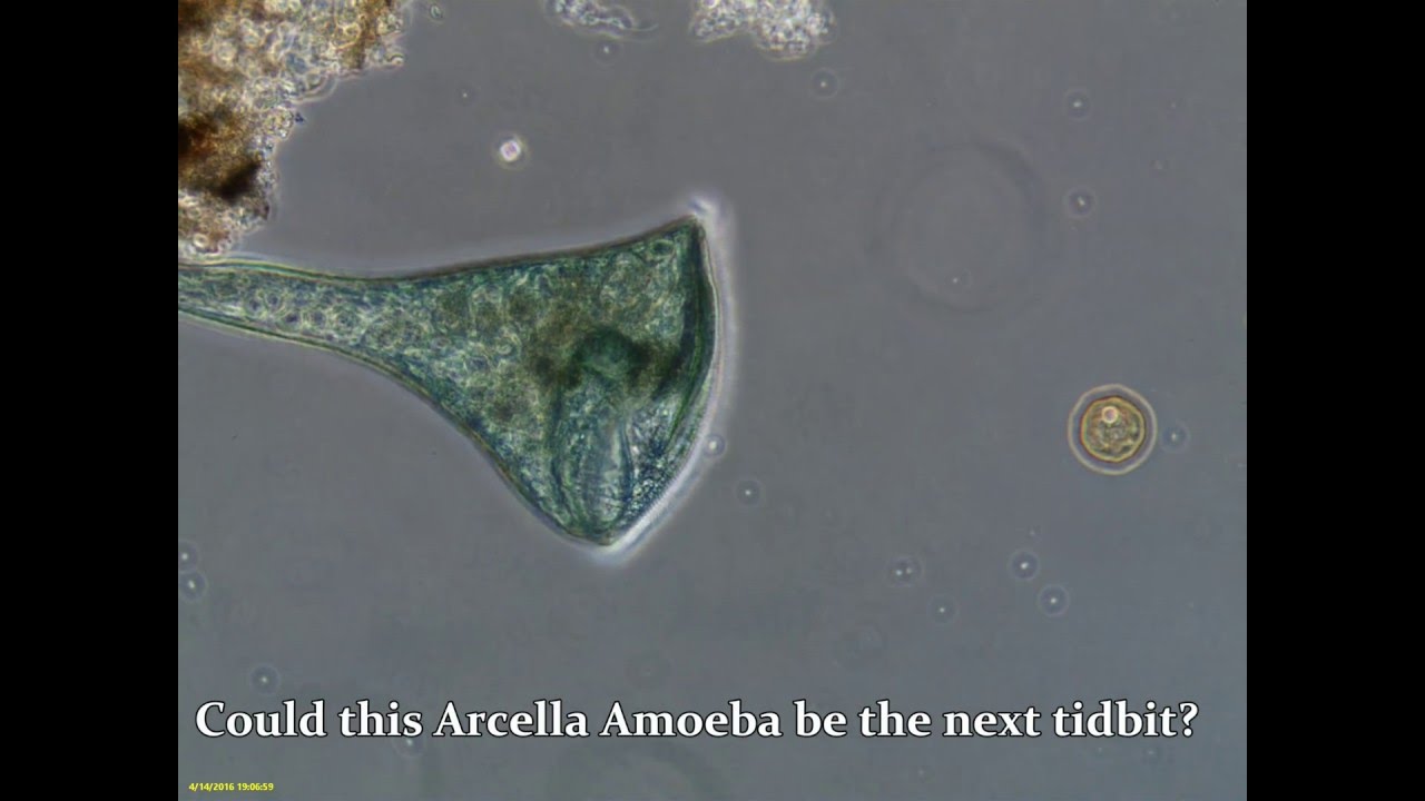 Stentor Eats Arcella