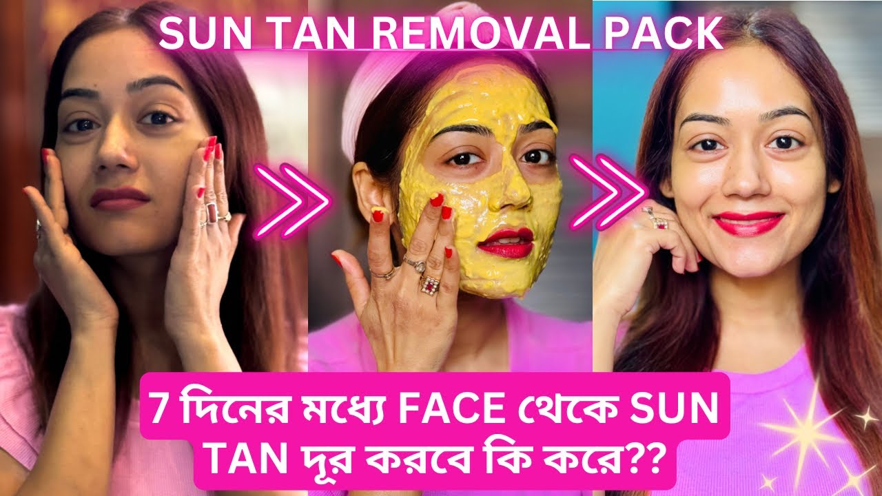 7 দিনের মধ্যে Face থেকে Sun Tan দূর করবে কি করে?| রোদে পোড়া ত্বক থেকে বাঁচার উপায়| #tanremoval #vlog