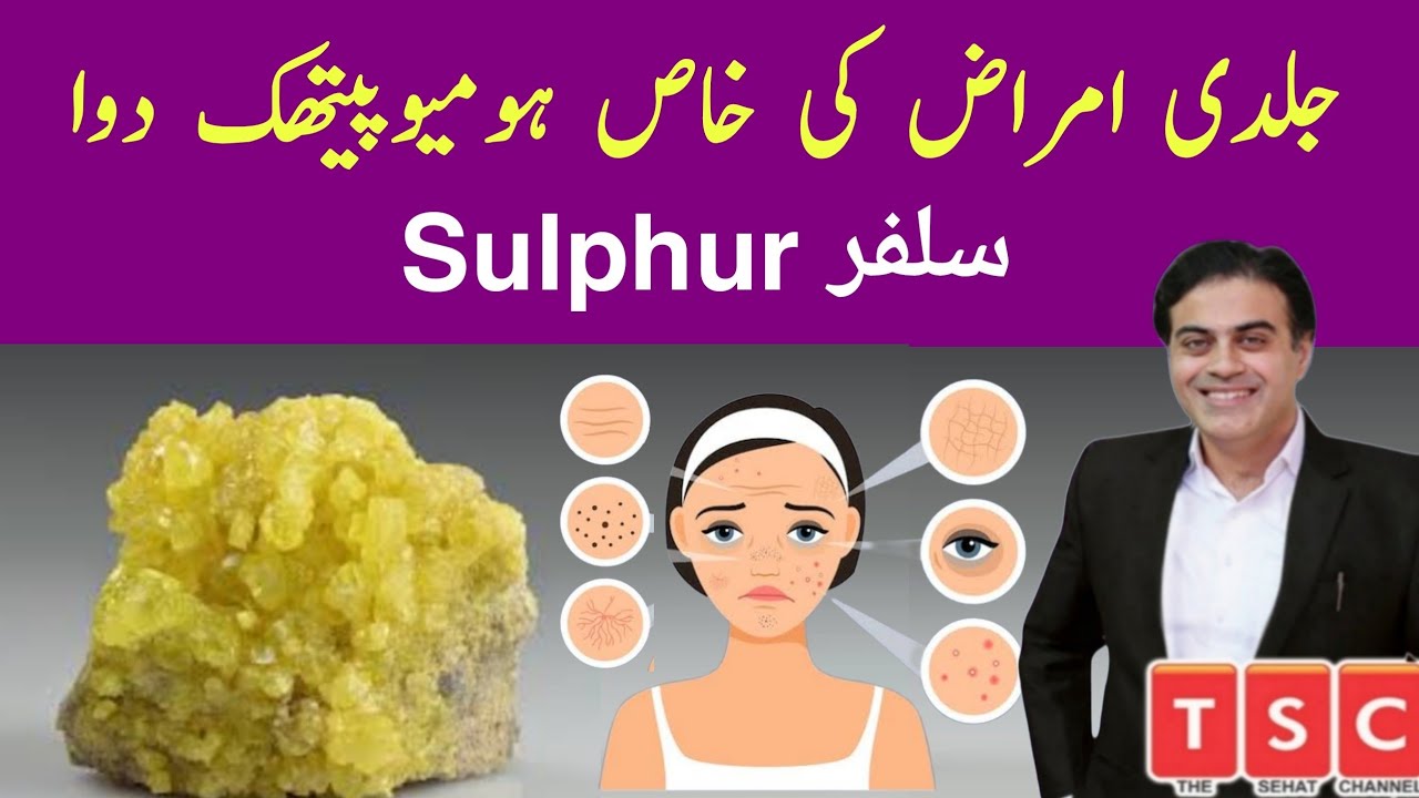 Sulphur homeopathic medicine | sulphur 30 |  Sulphur 200 symptoms | Uses and Benefits
