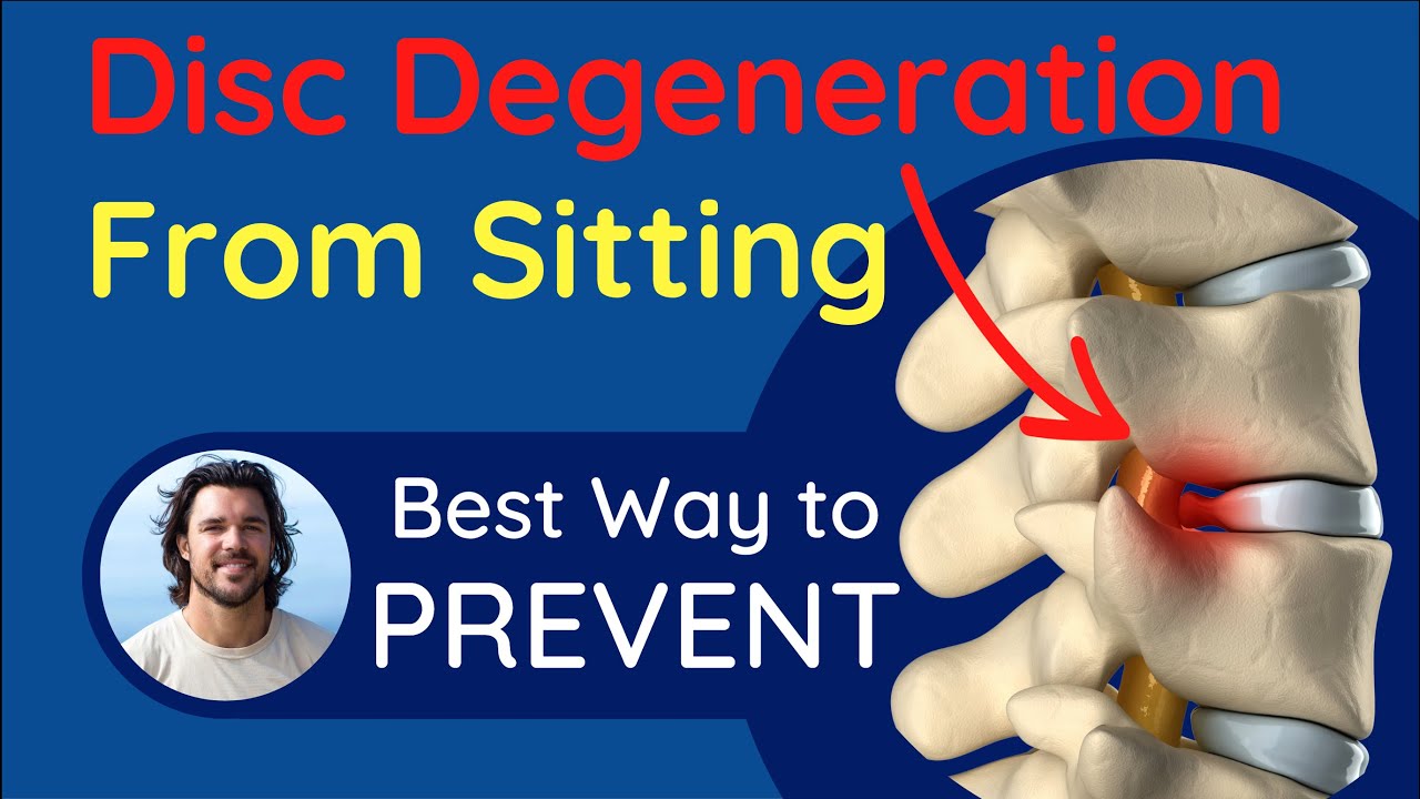 Fix Your Sitting Posture To Stop Back and Neck Pain | Effect on Your Discs
