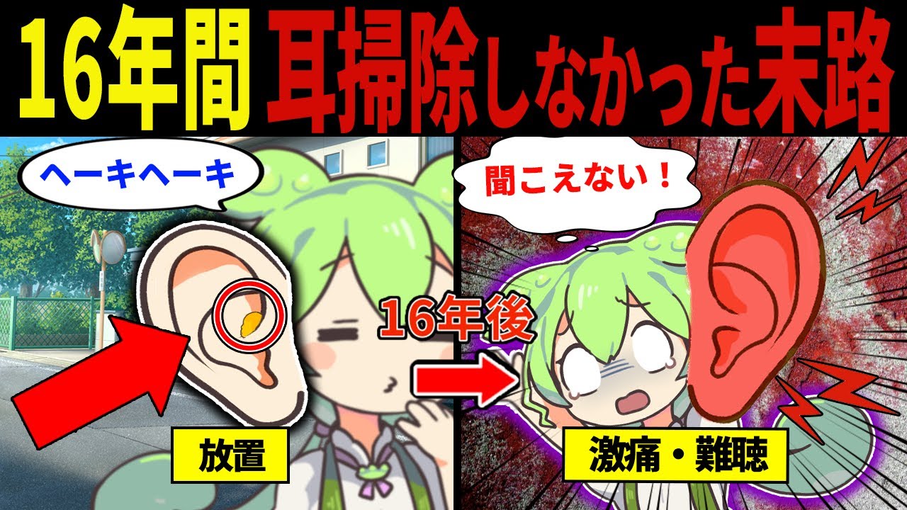 【実話】16年間耳掃除をしなかった男の末路【ずんだもん&ゆっくり解説】