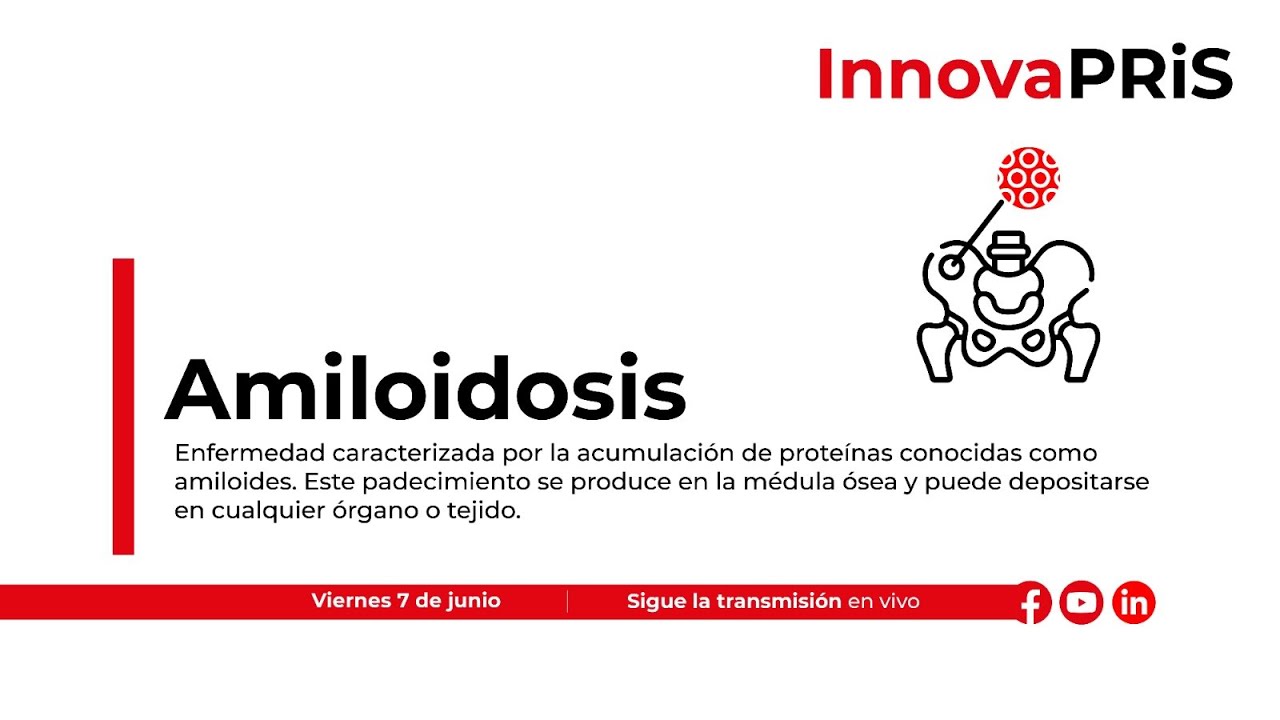 Amiloidosis