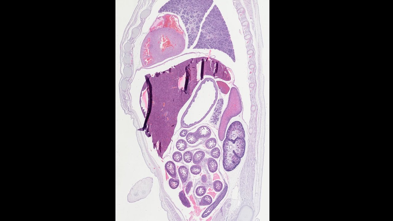 Histologický preparát lidského embrya - stáří 8 týdnů, TK 1,5 cm