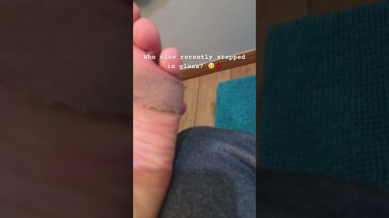I got glass in my foot!!! #subscribe #feet #hurt