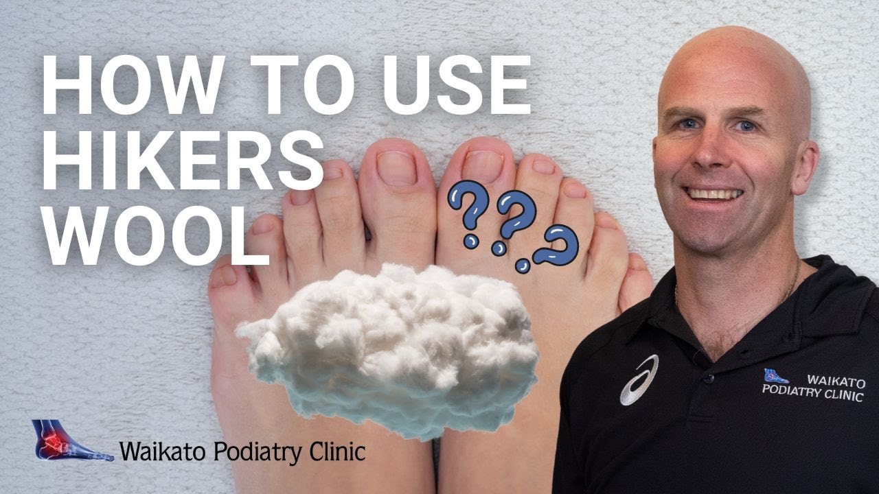 What Is Hiker's Wool And How To Use It? | Andrew Jones | Waikato Podiatry