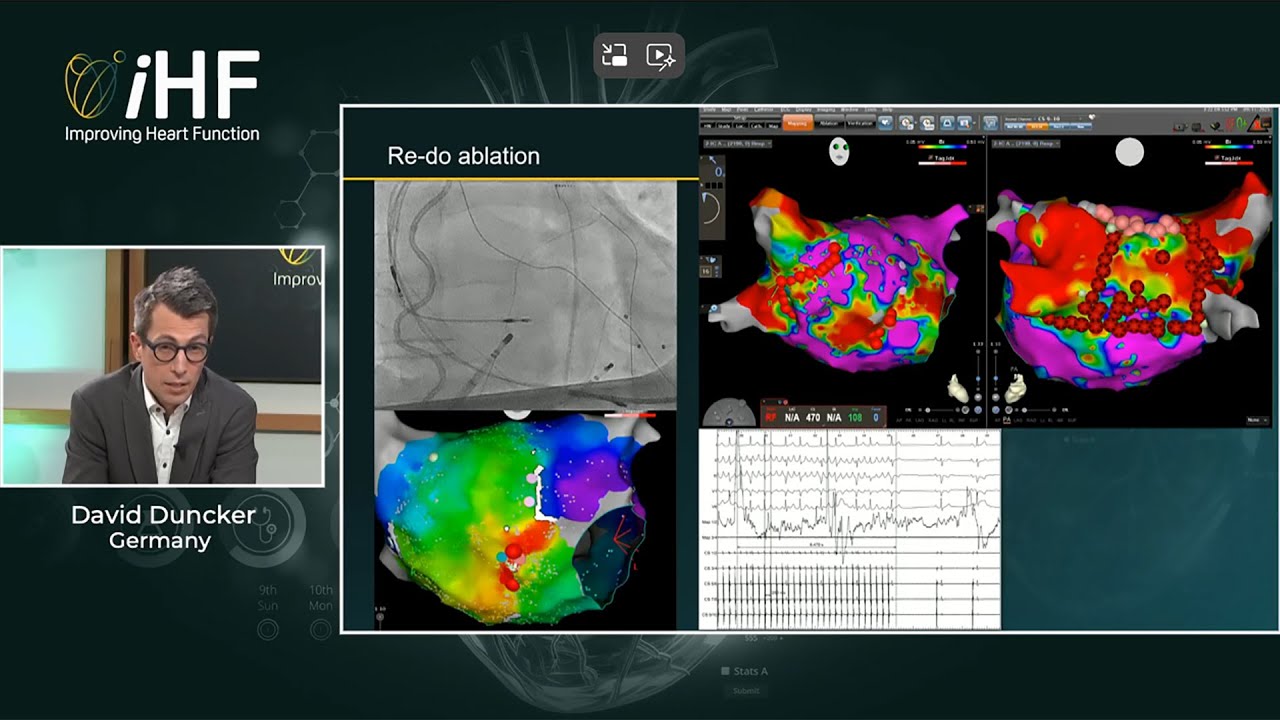Should atrial fibrillation ablation be the 5th pillar in HF management with atrial fibrillation?