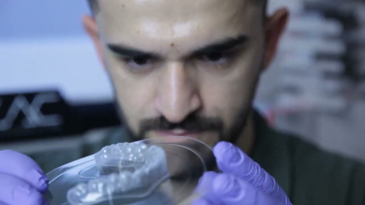 The full in-house clear aligner workflow - the Dental Axess way