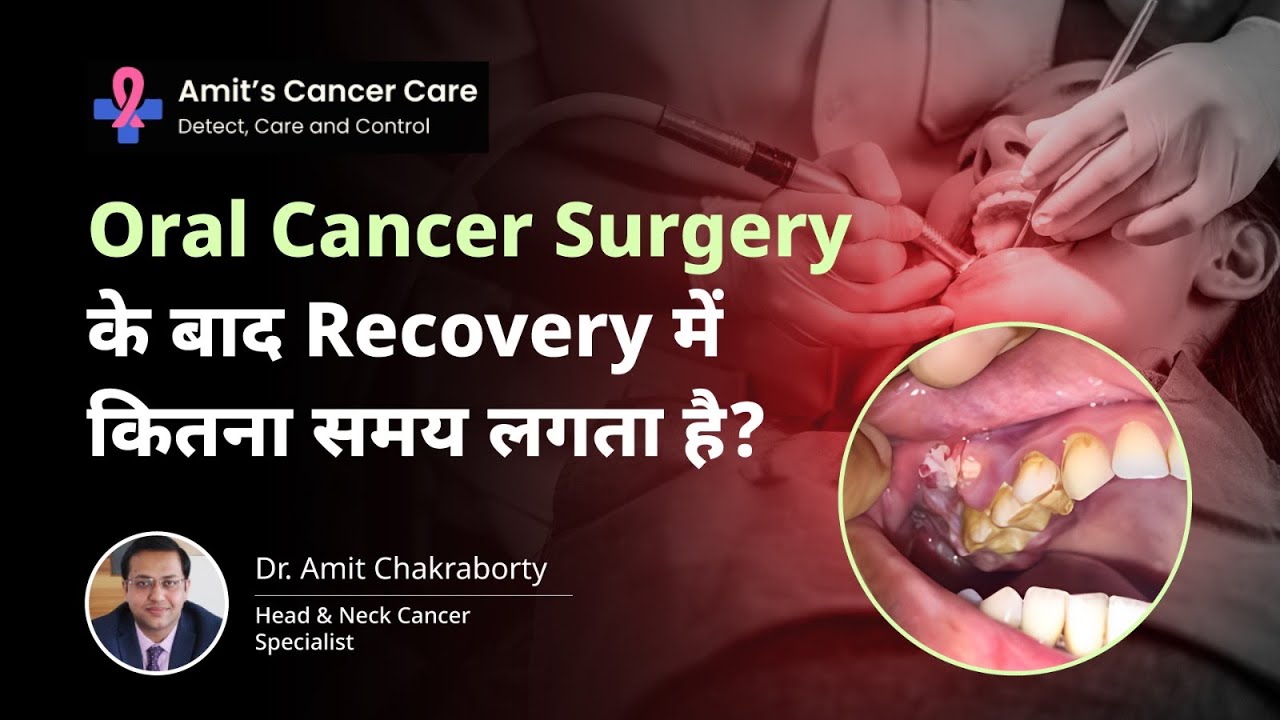 Oral Cancer के बाद ठीक होने में कितना समय लगता है? | From Liquid to Solid Diet |Dr Amit Chakraborty