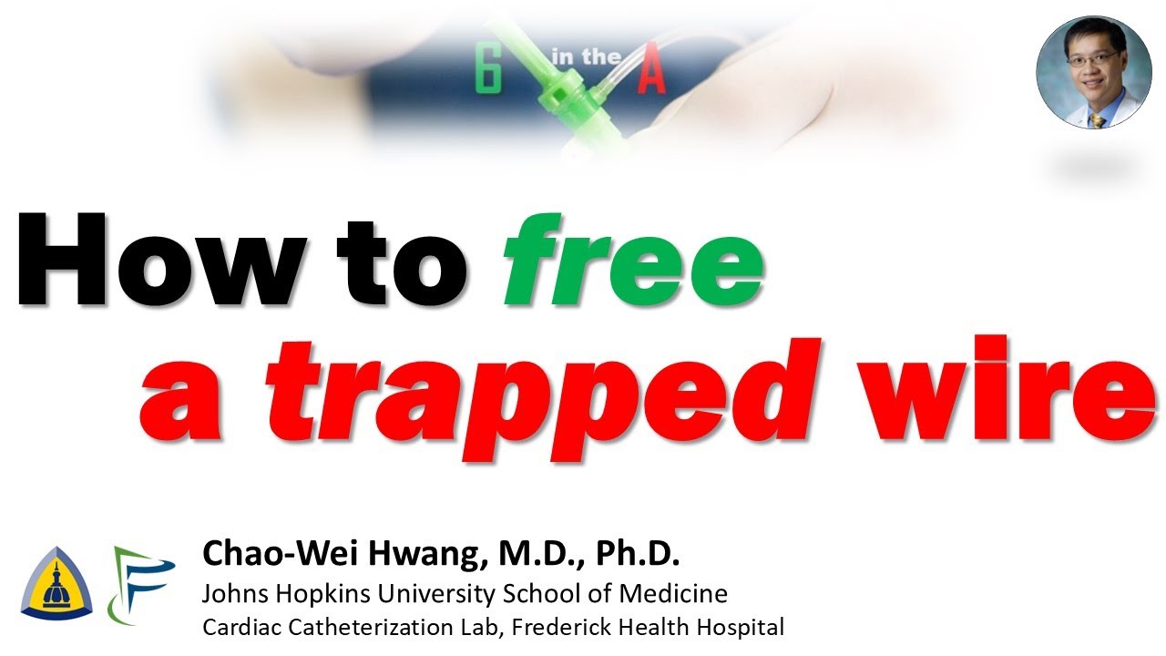 How to Free a Trapped Wire