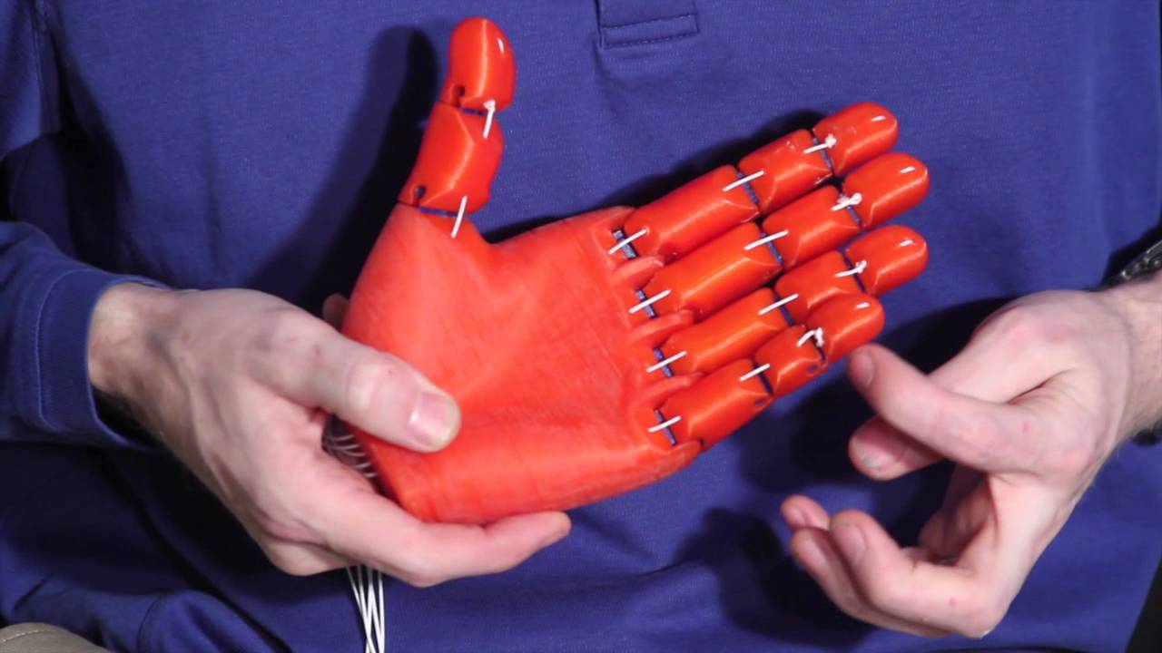 Review of the Flexy-Hand 3D printed prosthesis proof of concept (3D Universe)