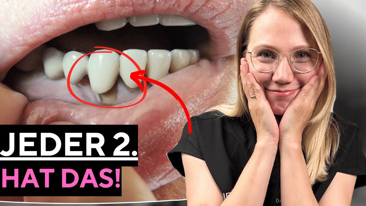 Was ist Parodontitis und ist sie heilbar?