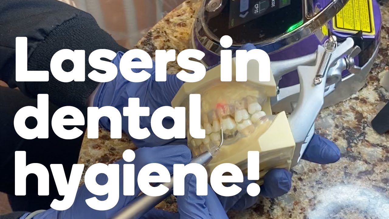 Four ways a dental hygienist can use lasers