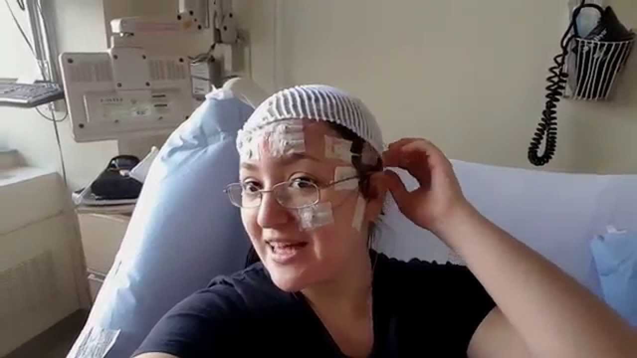 My Experience In The Epilepsy Monitoring Unit