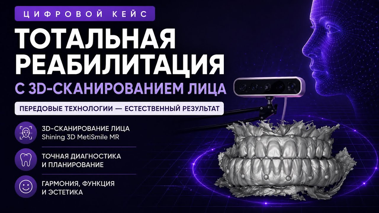 Тотальная реабилитация с 3D-сканированием лица | Цифровой кейс Shining 3D MetiSmile MR