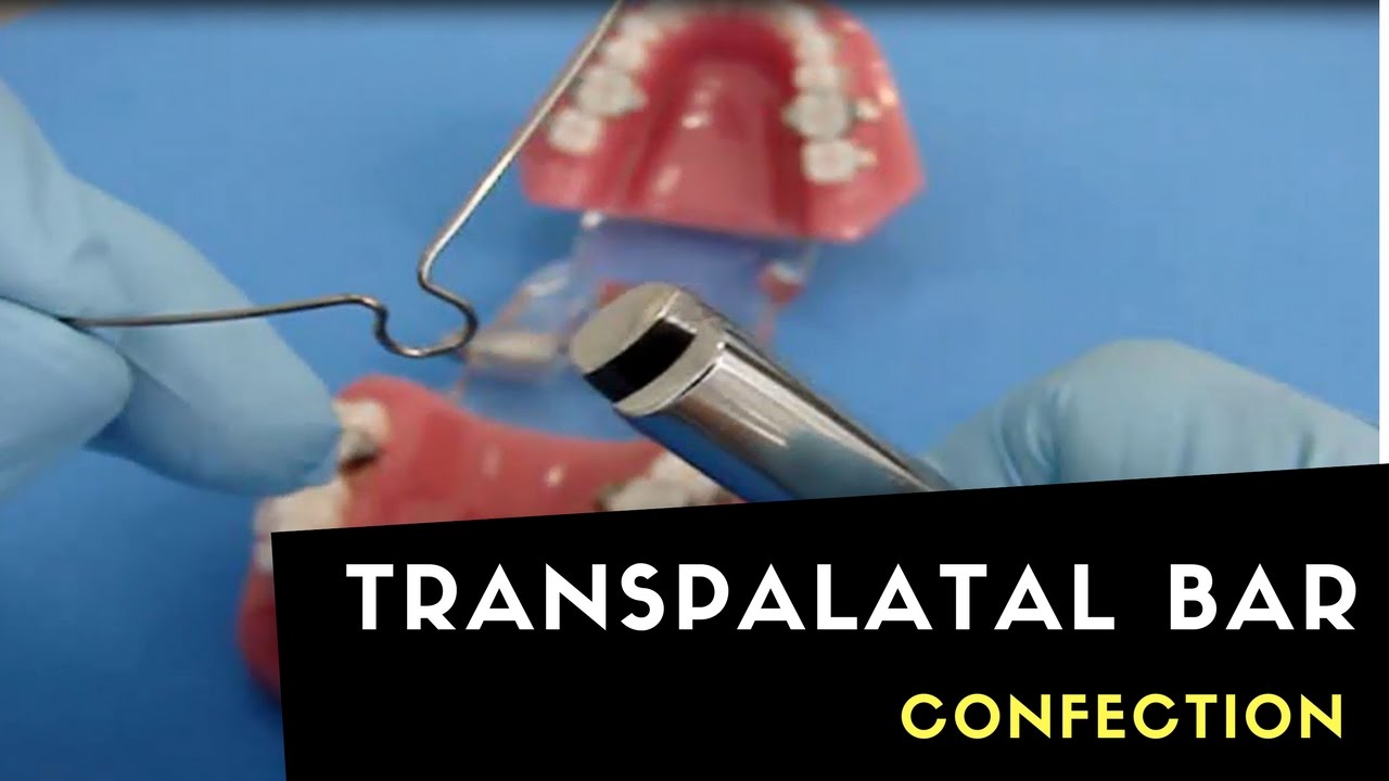 CONFECCTION OF TRANSPALATAL BAR