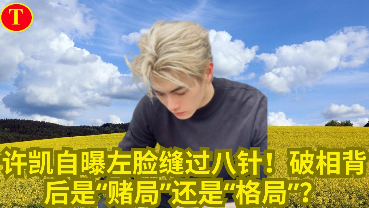 许凯自曝左脸缝过八针！破相背后是“赌局”还是“格局”？