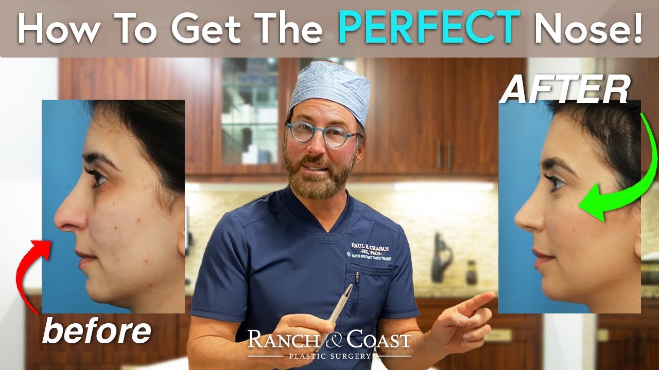 How to Get the PERFECT Nose Job!
