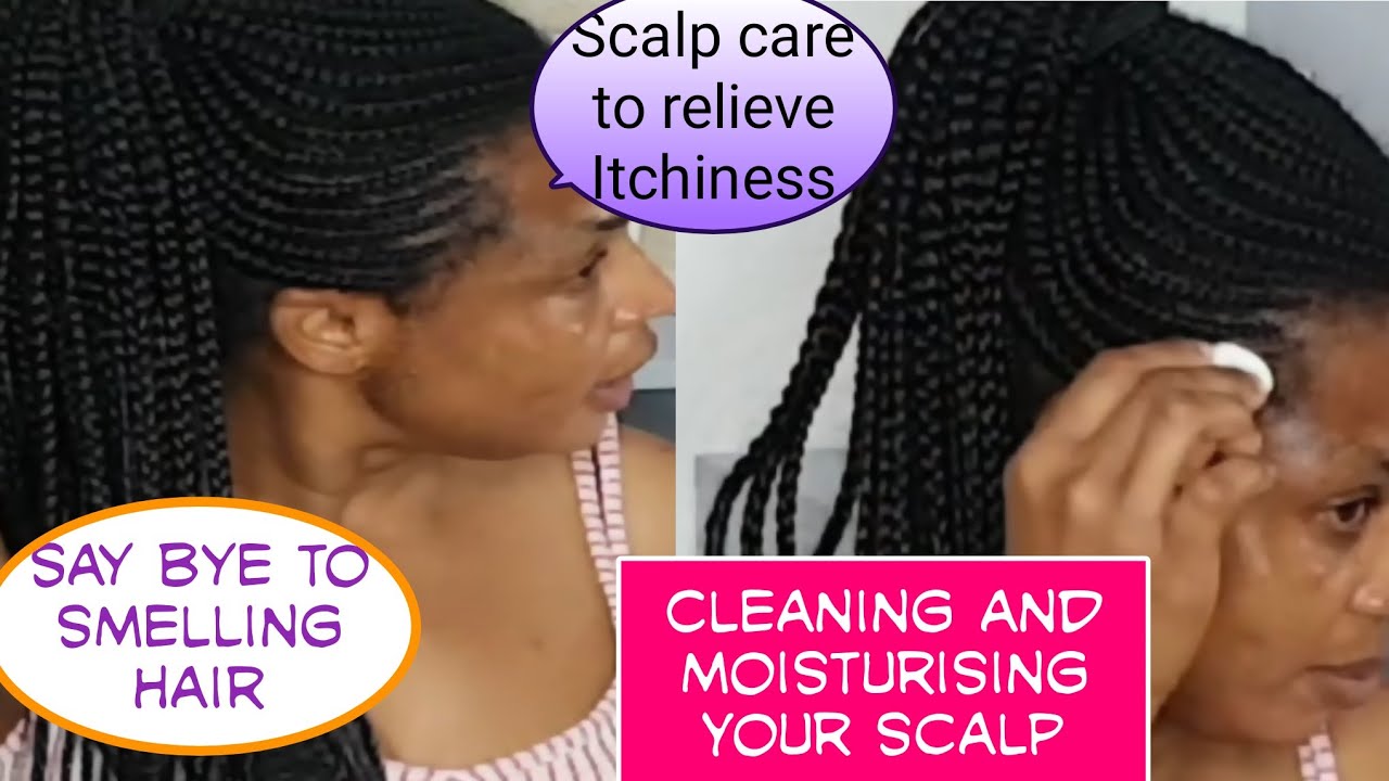 How to clean your scalp| get rid of smelling braids| cornrow|unclog pores for hair growth