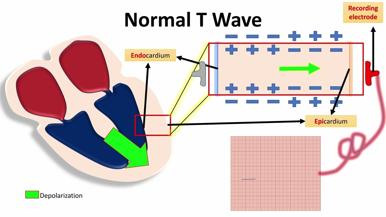 NORMAL T WAVE IN LIMB AND CHEST LEADS  "NORMAL ECG VALUES" | NARCOSIS😴🤤