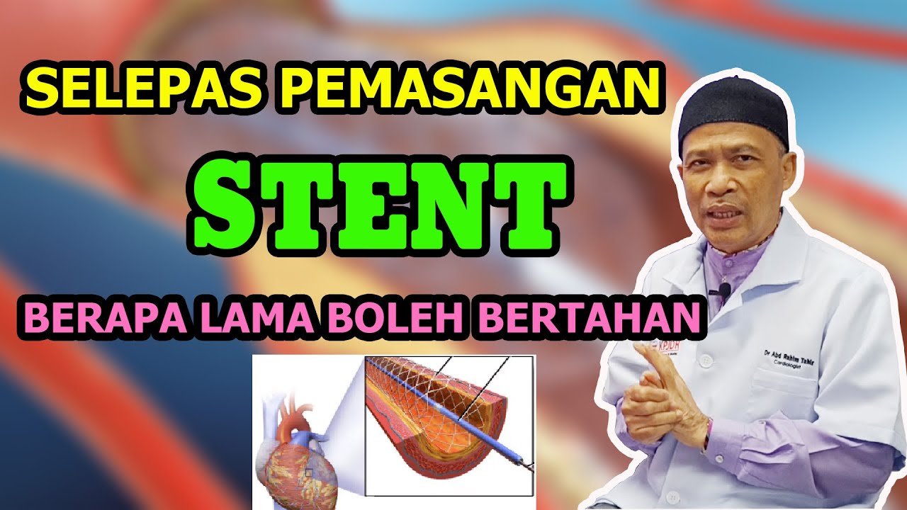 Jangka hayat pemasangan stent (jantung) - Dr Rahim