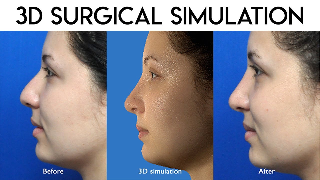 3D Surgical Simulation