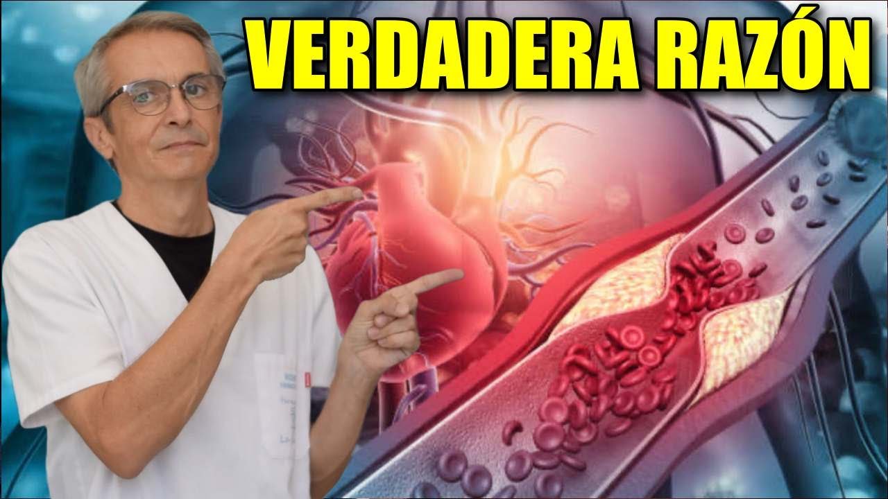 Por qué tus ARTERIAS se CALCIFICAN y se hacen RÍGIDAS 👉 VERDADERA razón