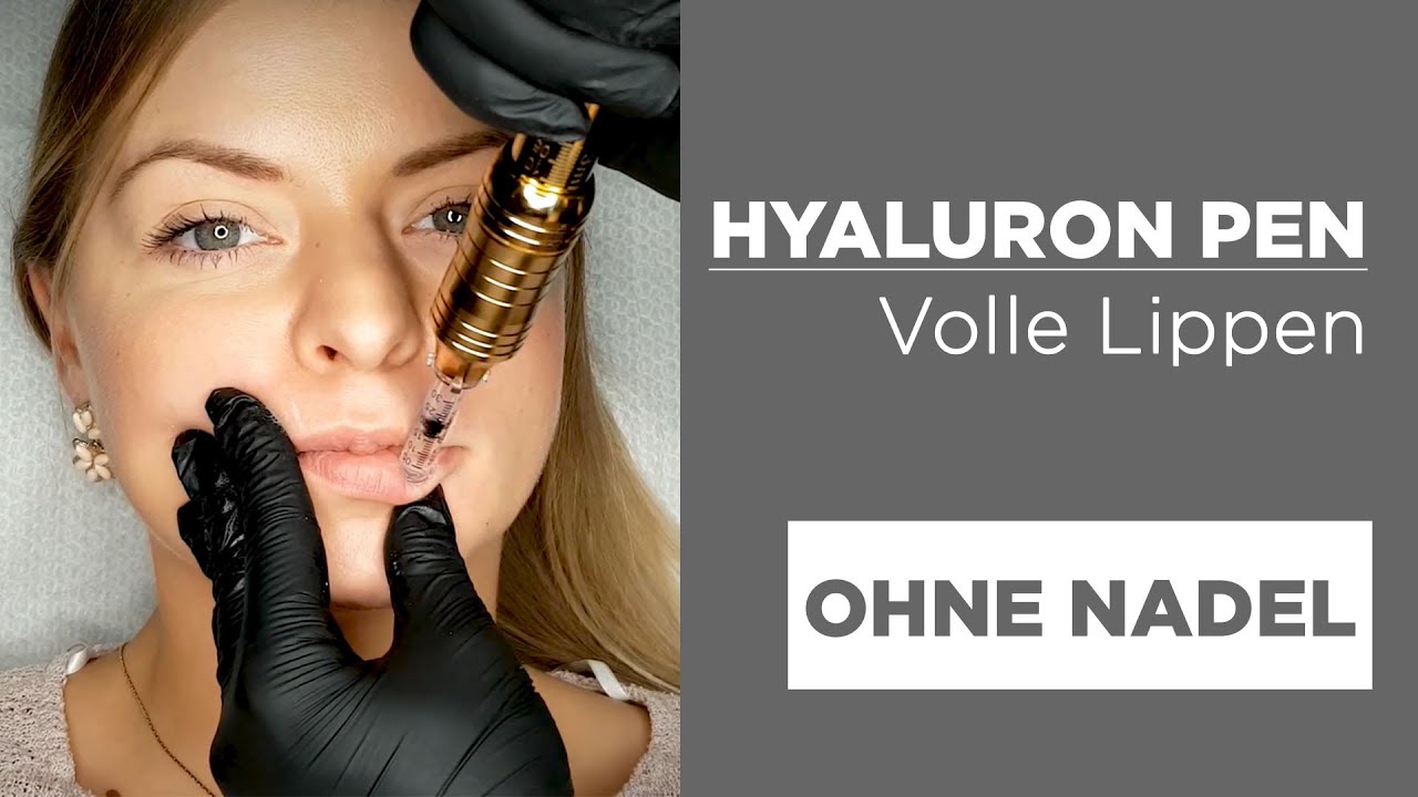 Hyaluron Pen LIPPEN VOLUMEN schmerzfrei und ohne Nadel!