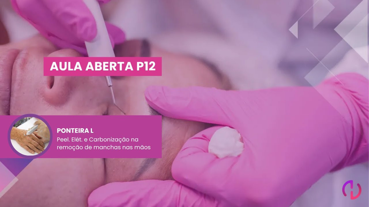 Aula Aberta #P12 - Ponteira L - Carbonização na Remoção de Manchas nas Mãos