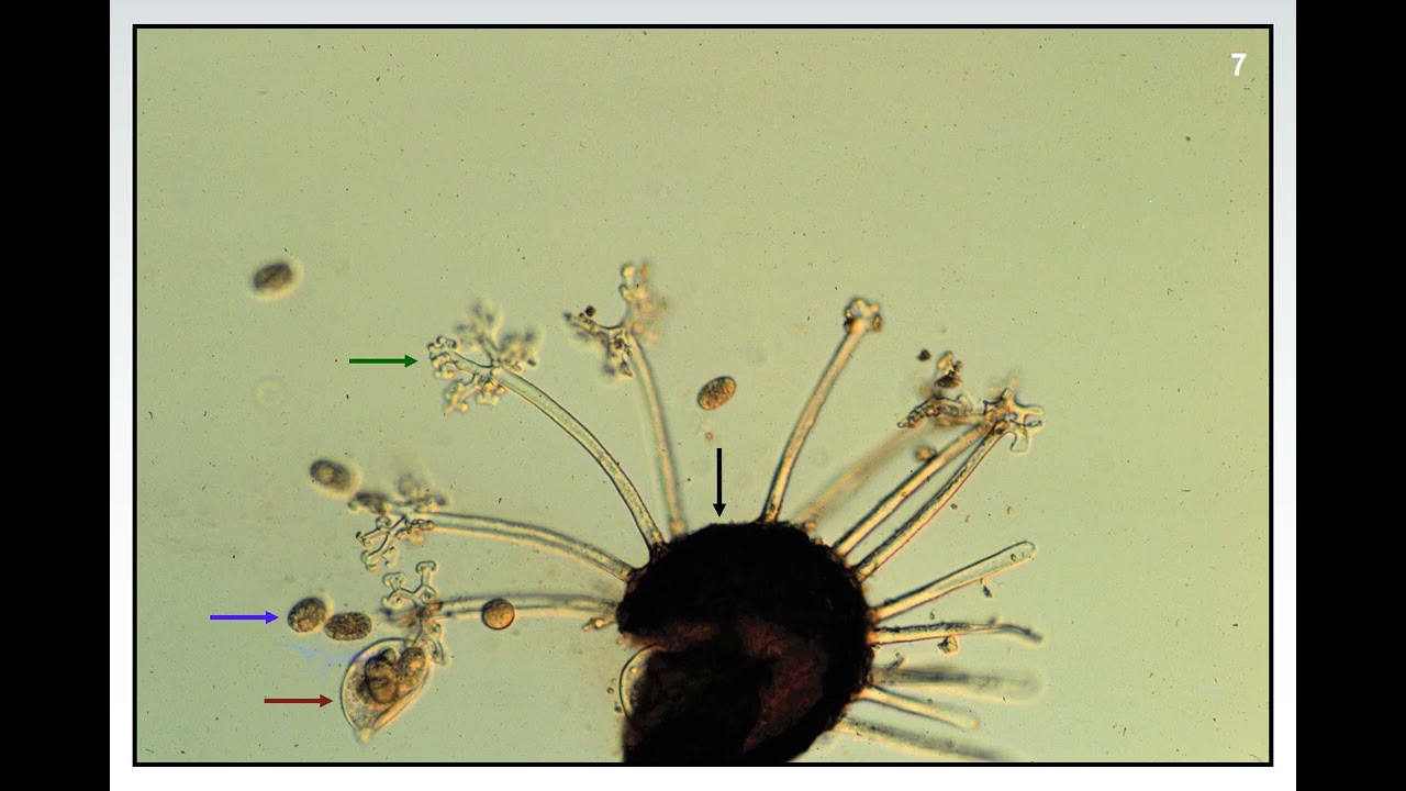Fundamentals of Plant Diseases - Slide 7 - FUNGI:  SEXUAL PRODUCTION
